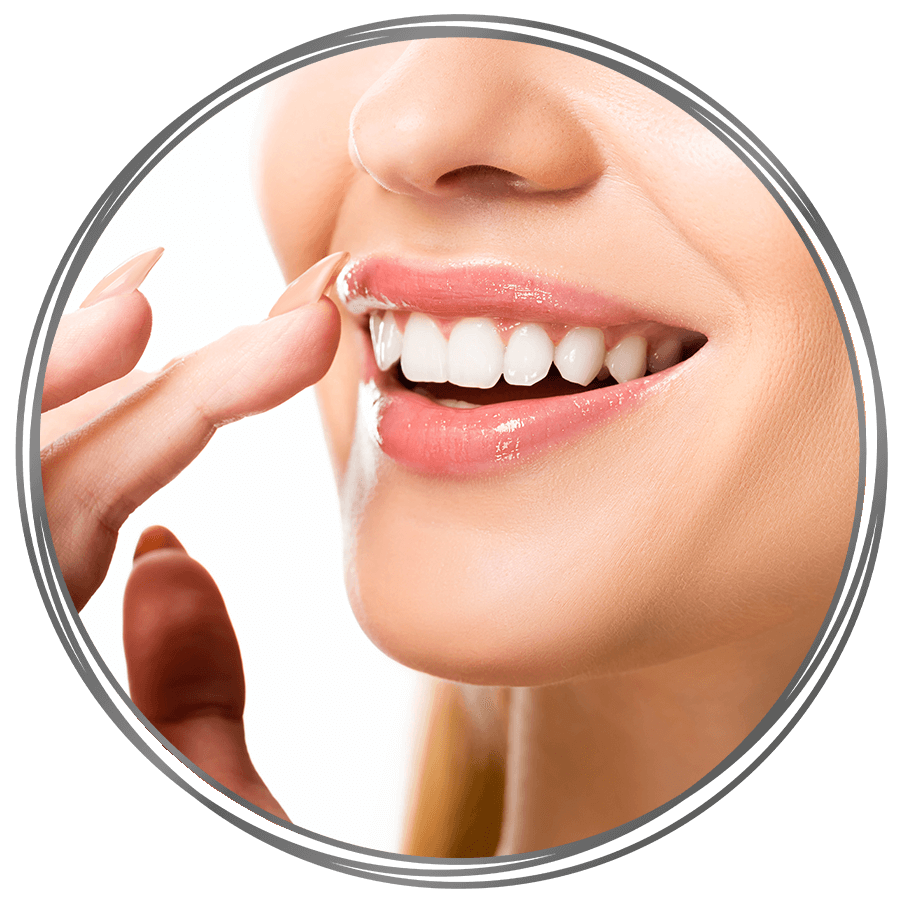 Diamoneers&trade; Veneers